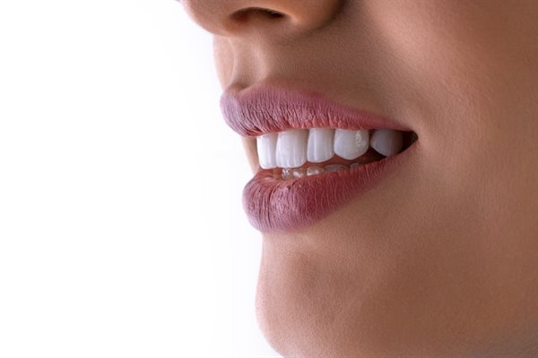 Clareamento dental — sorriso com dentes mais brancos