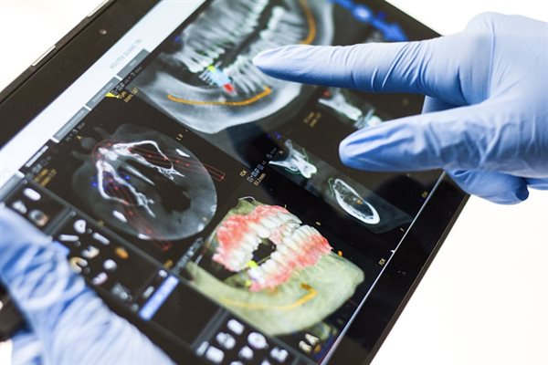 Endodontia — diagnóstico por imagem digital antes do tratamento de canal